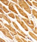 PCCA Antibody (Center)